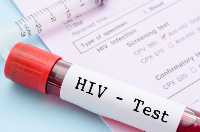 Выявляемость больных ВИЧ в Забайкалье осталась на уровне 2019 года