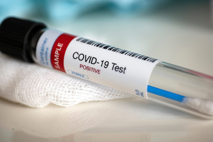 Лаборатория «Юнилаб» в Чите начала выполнять анализы на коронавирус