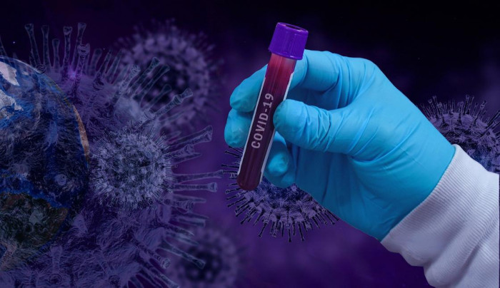 Специалисты назвали причины ложных тестов на коронавирус