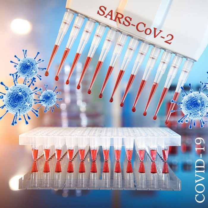 Тест на антитела к коронавирусу начала делать лаборатория «ЮНИЛАБ» в Чите