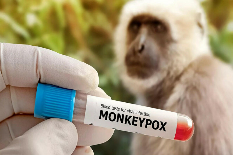 Лишь 10% читинцев боятся заболеть оспой обезьян – опрос
