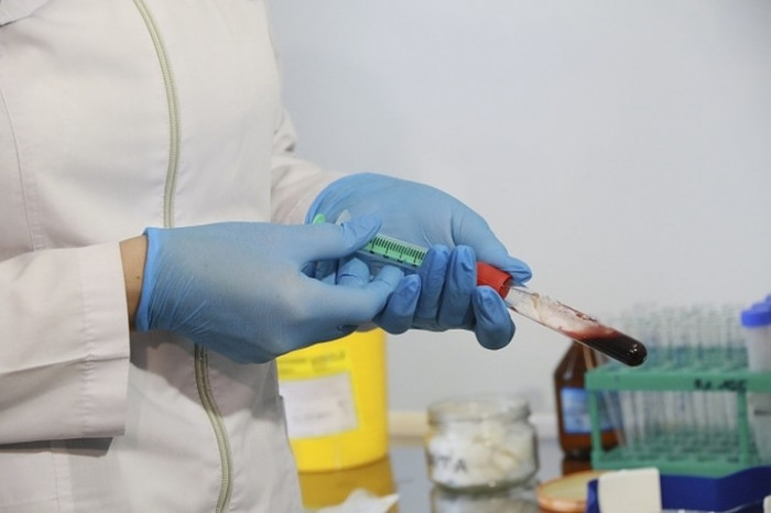 Число заболевших коронавирусом в Забайкалье выросло на 62
