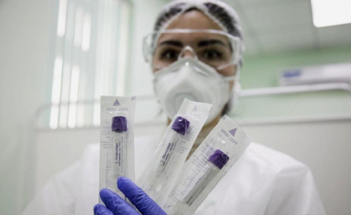Лаборатории в Забайкалье могут проверить 1 300 тестов на коронавирус в день