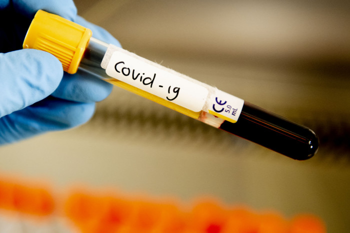 Анализы показали коронавирус у женщины и её ребёнка в Забайкалье – «МК в Чите»